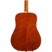 Epiphone Dove Studio - Solid Top Fishman Sonitone Elektro Akustik Gitar (Violin Burst)